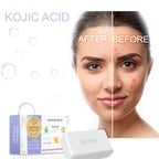 360Feel Soap with Kojic Acid, Glutathione,Alpha-Arbutin, Aloe Vera, Vitamin C & E, Paraben-Free, Cruelty-Free 75g suitable for all skin types | men and women