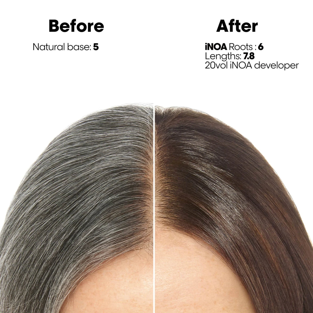 Loreal Inoa Ammonia Free Hair Color 60G + 20Vol 6% Developer 1000Ml Combo